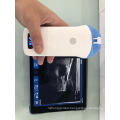 Portable Wireless Ultrasound Scanner Conevx Probe 3.5MHz Innovative Medical Device